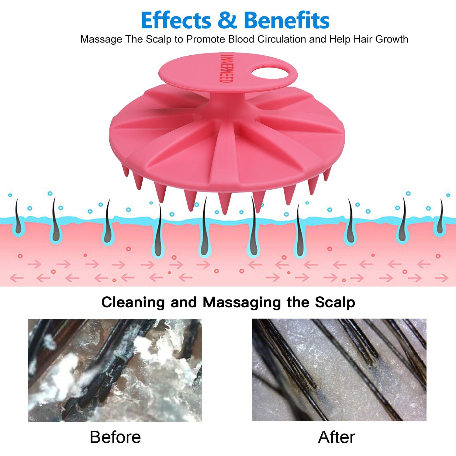 SJ-04 Scalp Massager Brush | Soft Silicone Bristles for Gentle Hair & Scalp Care